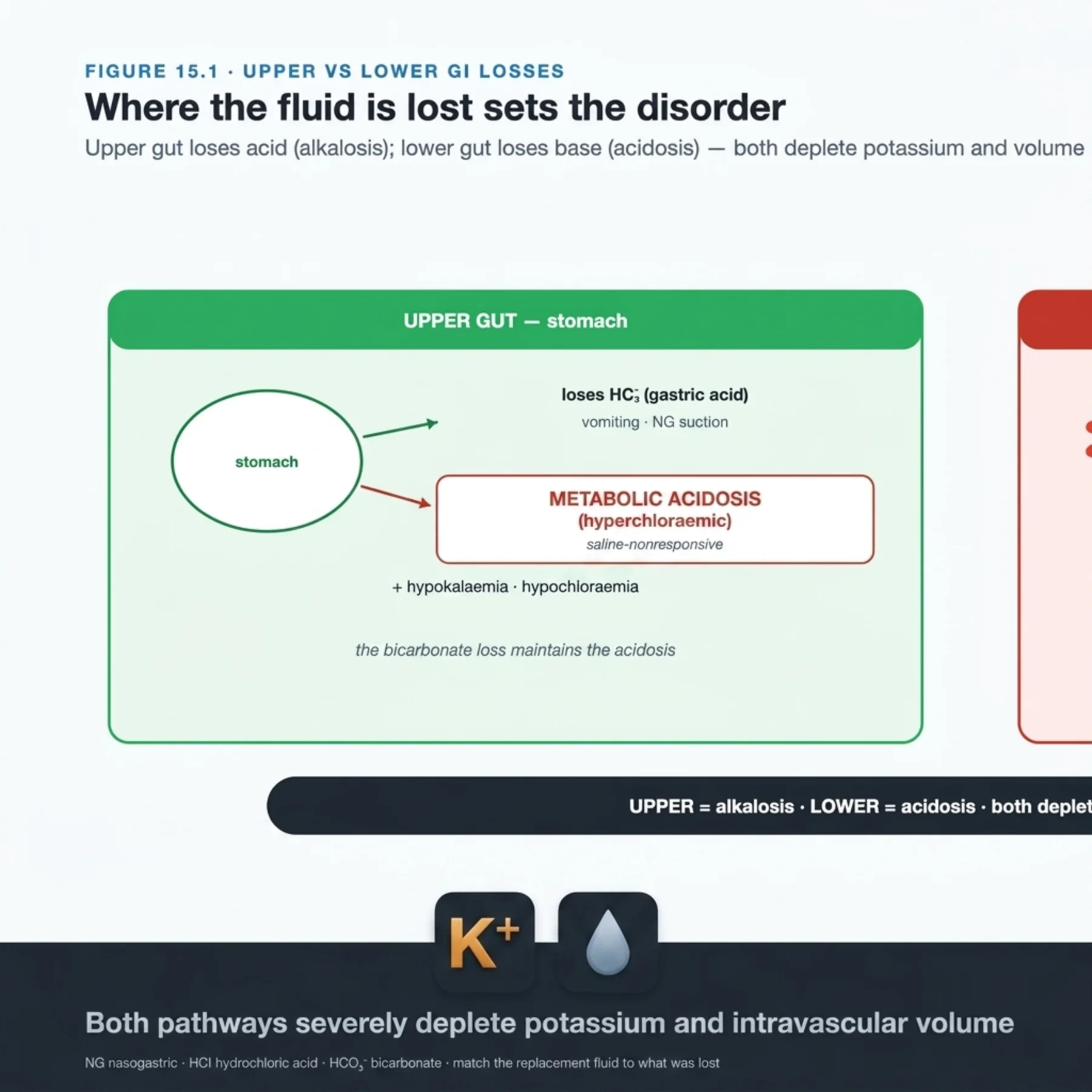 Figure 15.1 - Upper versus Lower Gastrointestinal Losses