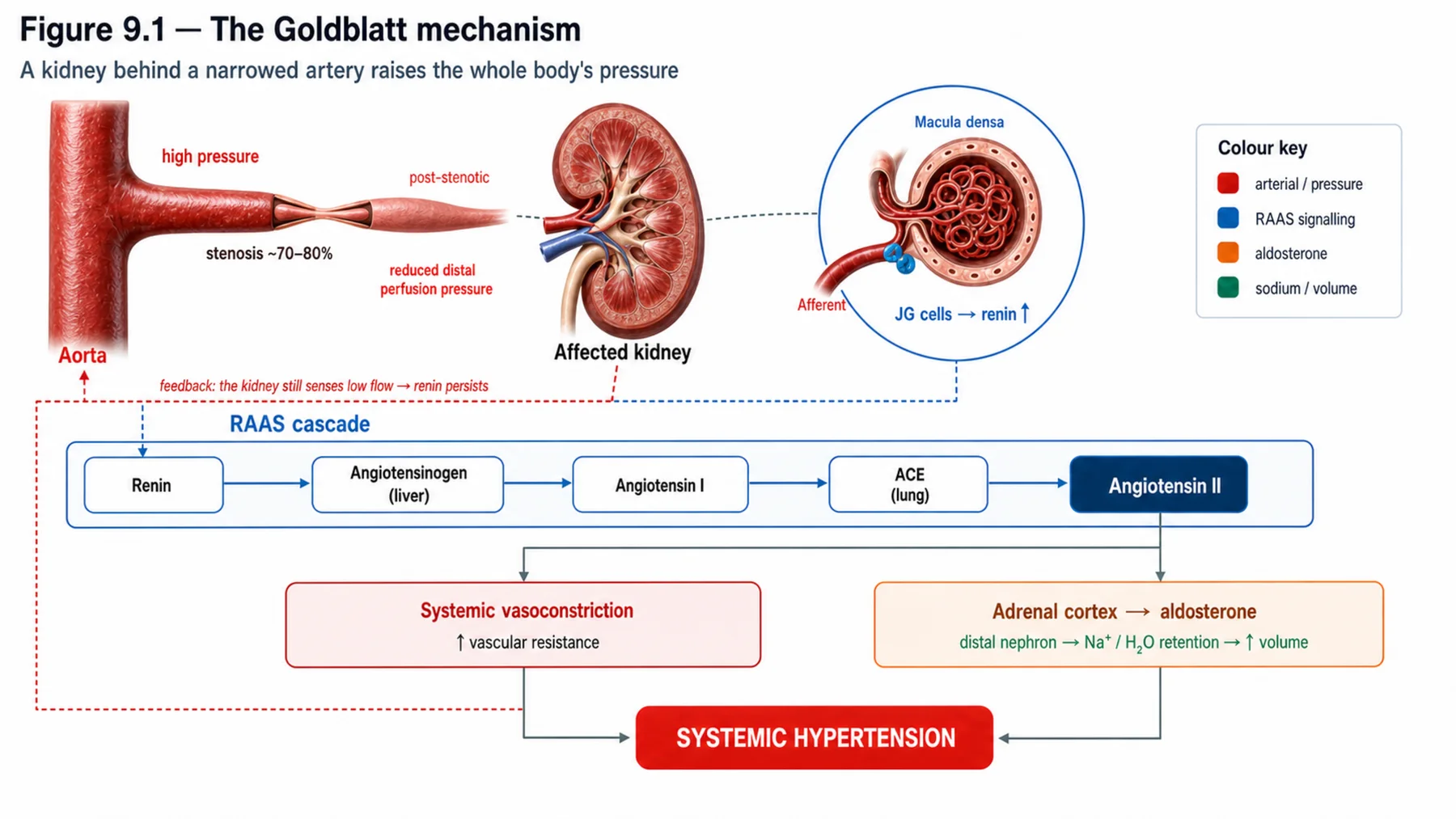Figure 9.1 - The Goldblatt mechanism