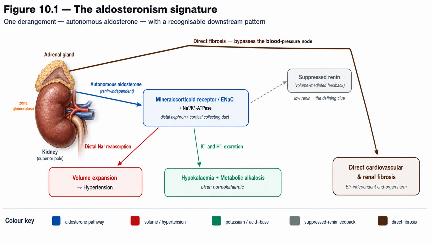Figure 10.1 - The aldosteronism signature