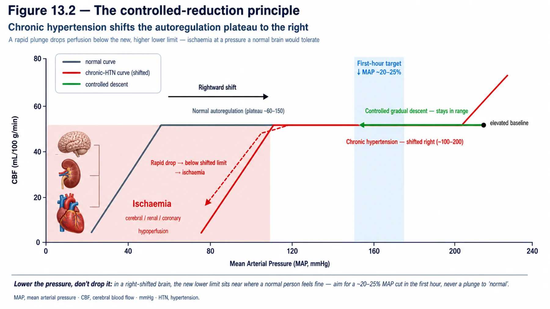 Figure 13.2 - The controlled-reduction principle