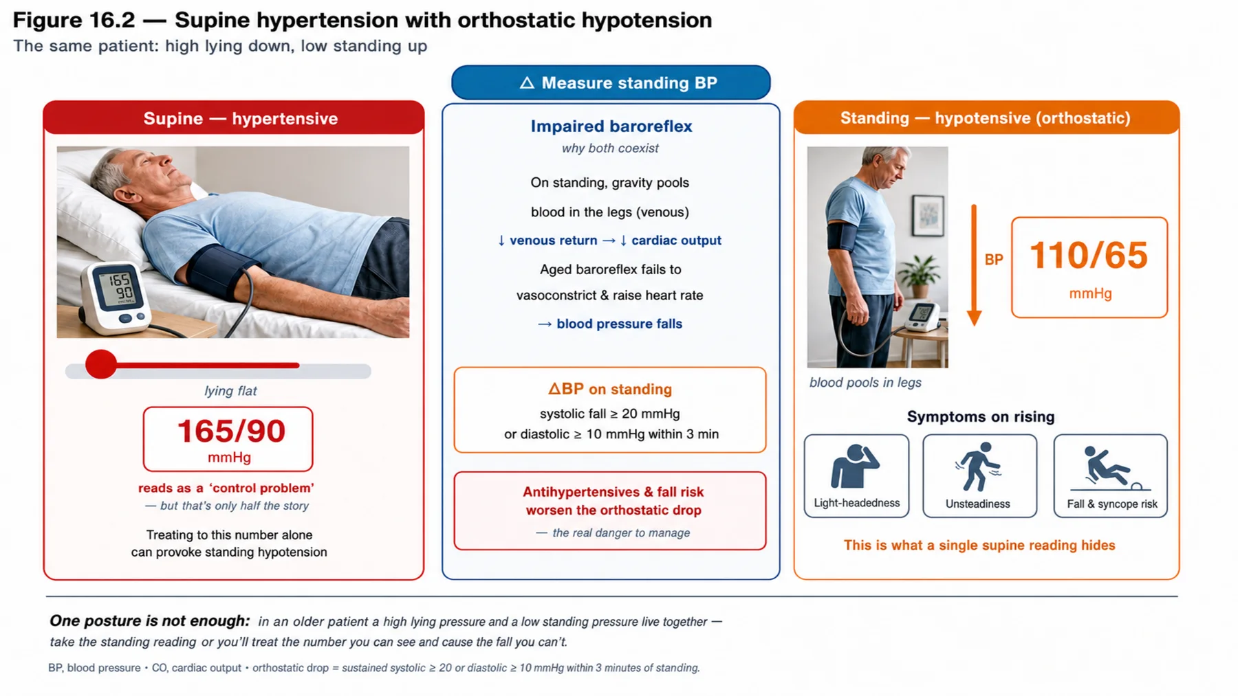 Figure 16.2 - Supine hypertension with orthostatic hypotension