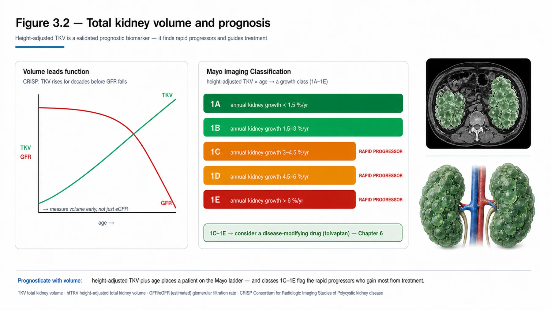 Figure 3.2 - Total kidney volume and prognosis