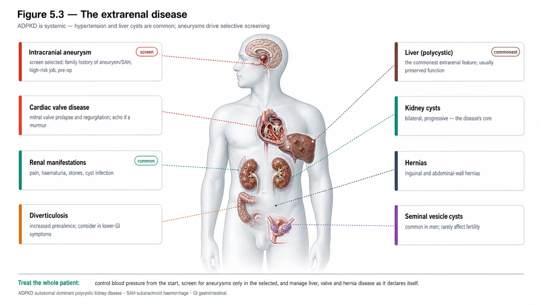 Figure 5.3 - The extrarenal disease