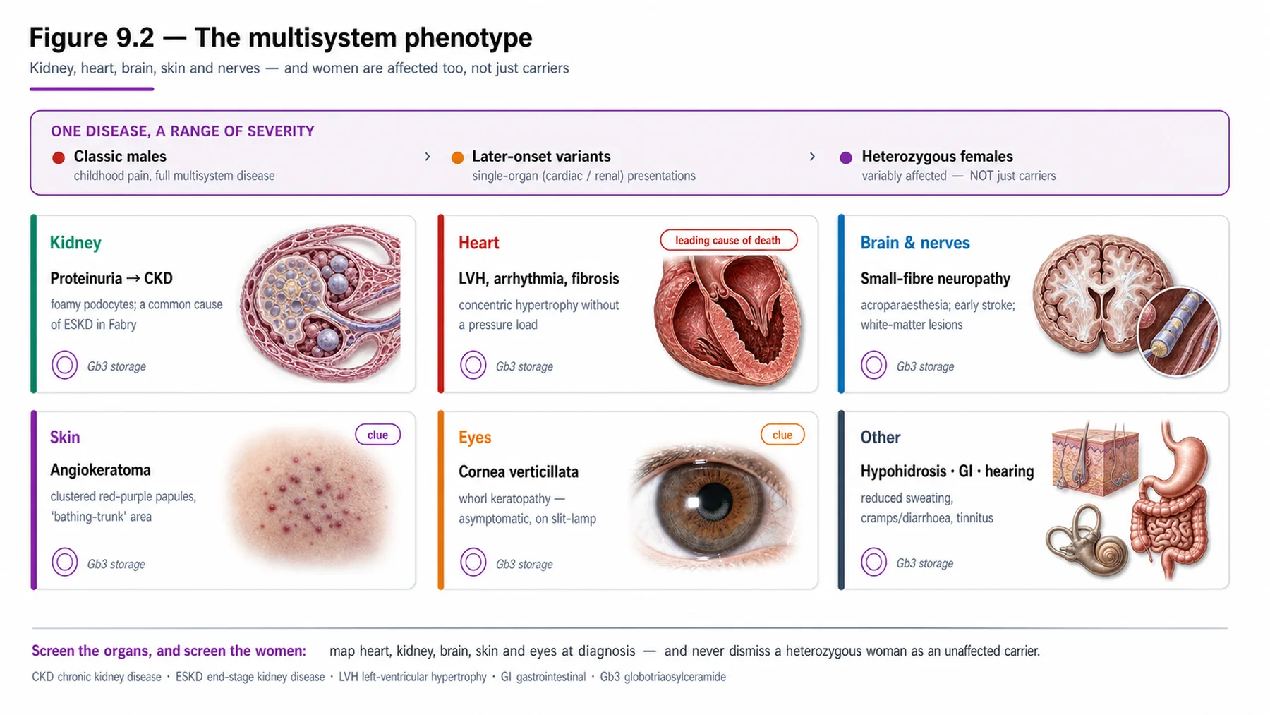 Figure 9.2 - The multisystem phenotype