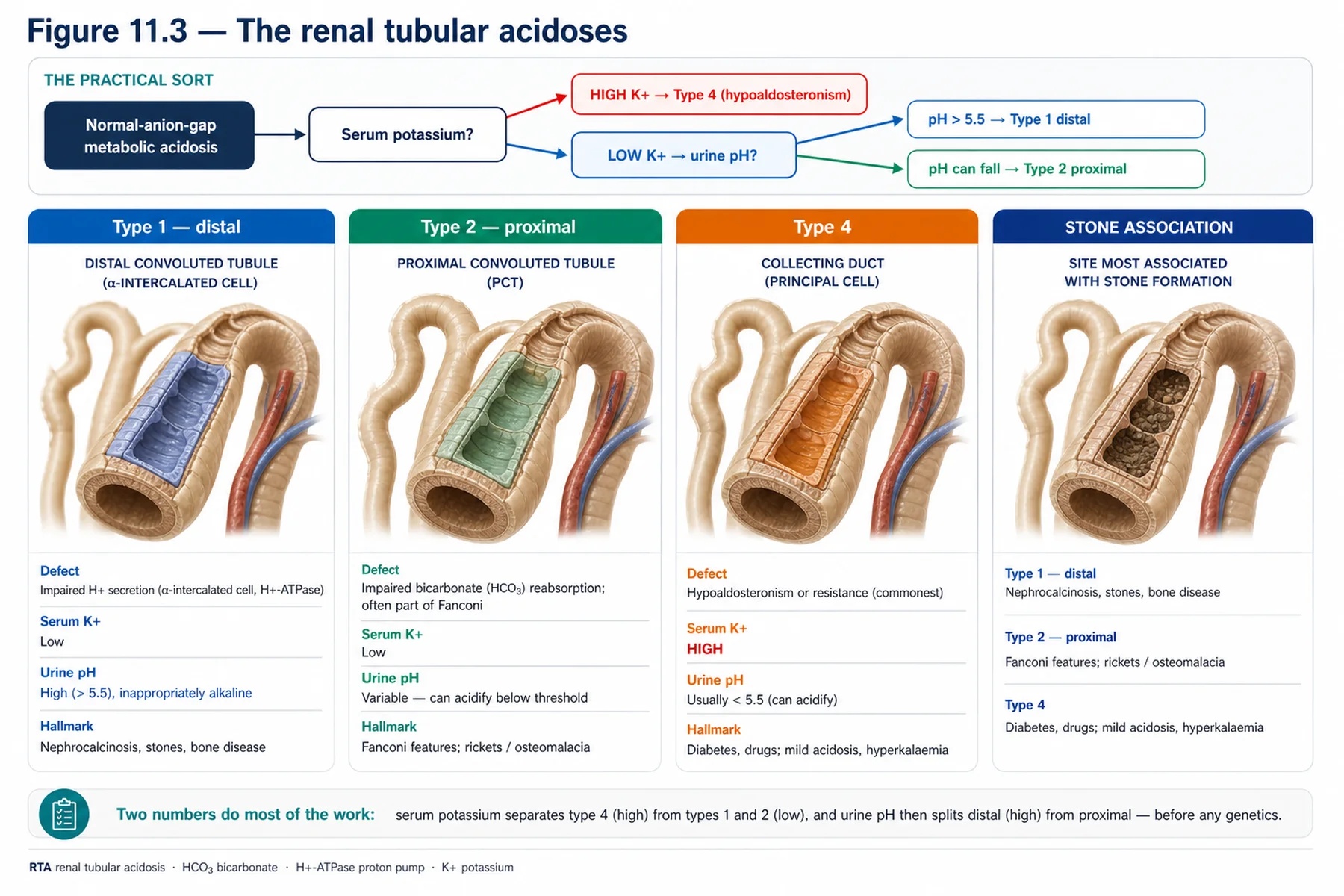 Figure 11.3 - The renal tubular acidoses