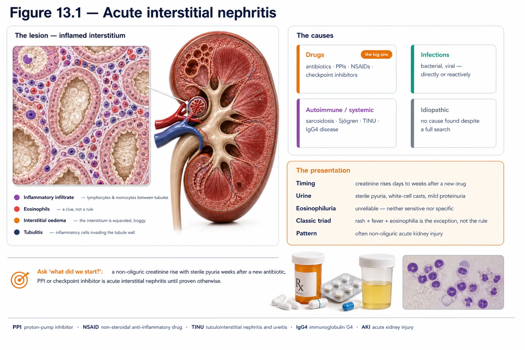 Figure 13.1 - Acute interstitial nephritis