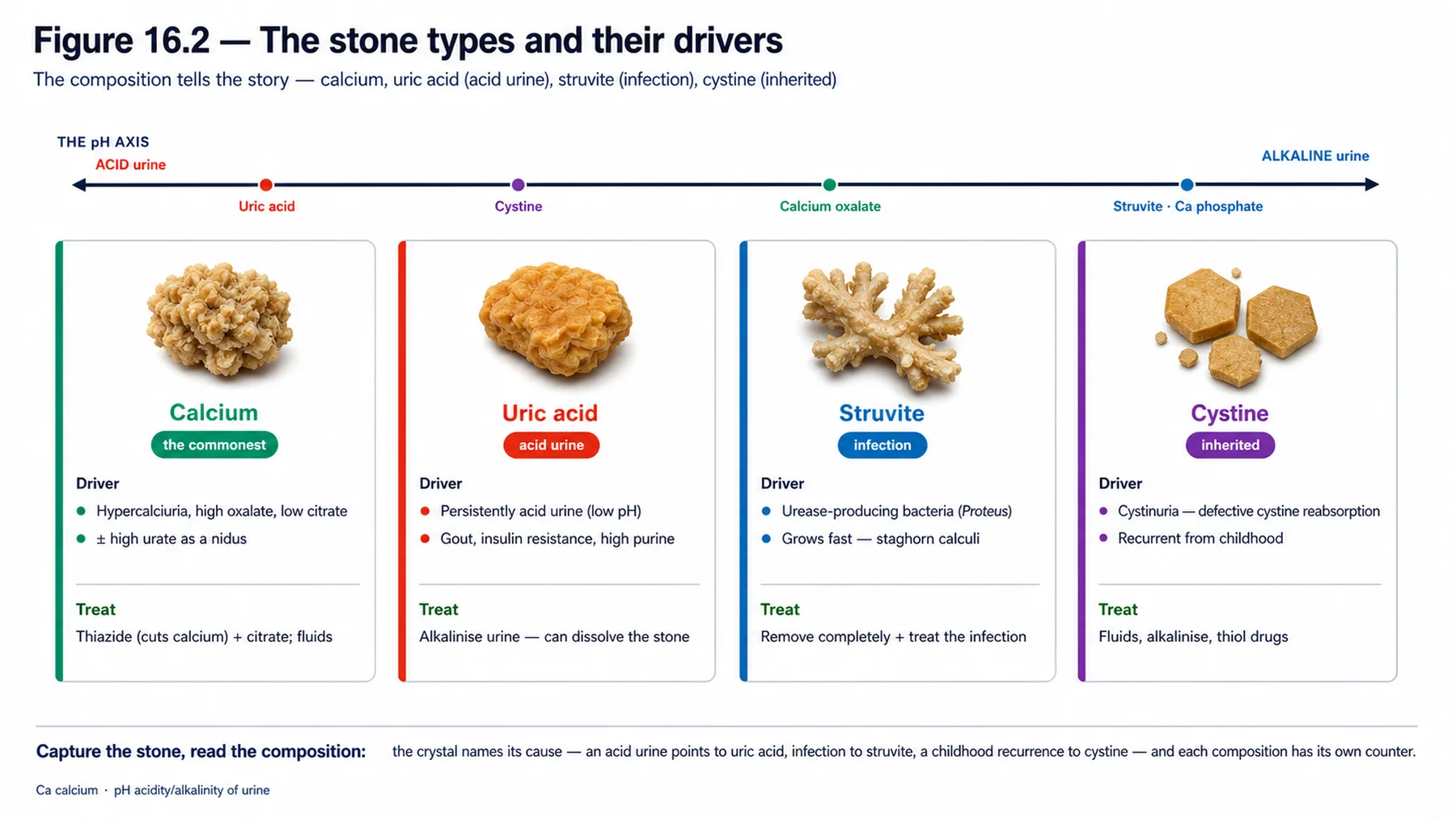 Figure 16.2 - The stone types and their drivers