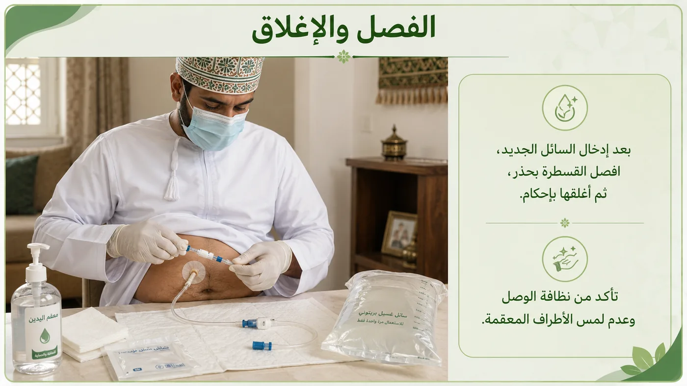 فَصل القسطرة وإغلاقها
